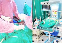 मलंगवा मै पहीलो पटक एपेन्डिक्सको सफल शल्यक्रिया