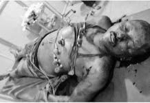 राैतहटमा गाेली चल्यो,एकको मृत्यु तीन घाइते