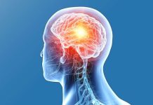 ब्रेन ट्युमर वा ब्रेन क्यान्सर भनेको के हो, प्रारम्भिक चरणमै कसरी थाहा पाउने ?