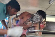 रूबी हत्या प्रकरण: जलेका मुख्य आरोपीलाई उपचारका लागि किर्तिपुर पठाईयो