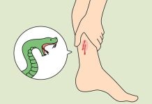 गोमन सर्पले डसेपछि झारफुकको भरपर्दा महिलाको मृत्यु